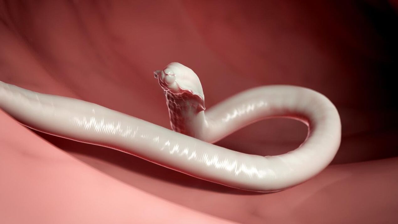 parasitärer Wurm des Menschen